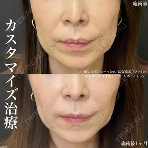 ルラ美容クリニック 名古屋栄院 / ルラスキンクリニック 名古屋栄院 関戸 優医師の症例