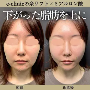 eクリニック 横浜みなとみらい院 八ヶ代 康将医師の症例