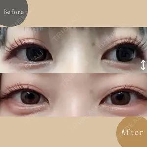 AZ BEAUTY CLINIC 木村 潤医師の症例