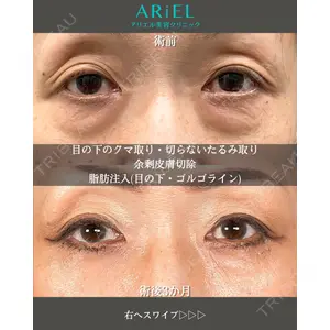 アリエル美容クリニック 大宮院 鈴木　桂介医師の症例