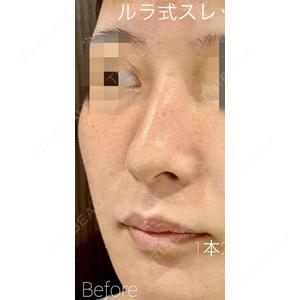 ルラ美容クリニック 渋谷本院 武内 大医師の症例