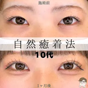 ルラ美容クリニック 札幌院 佐藤 雄紀医師の症例