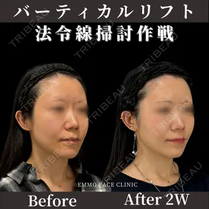 EMMO FACE CLINIC 東京三田院 木之下 哲彦医師の症例