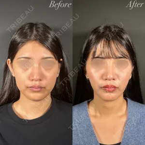 R Beauty CLINIC 名古屋院 木村 尚大医師の症例