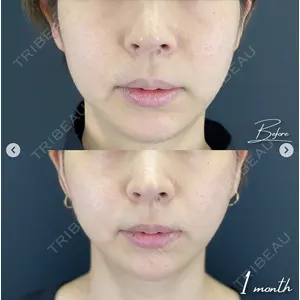 湘南美容クリニック 銀座院の症例