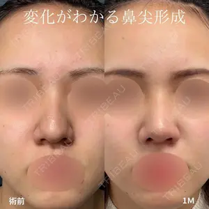グローバルビューティークリニック 大阪院 大阪院院長 羽根和秀医師の症例