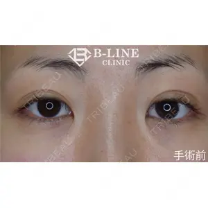 B-LINE CLINIC 池袋院 小池 康弘医師の症例