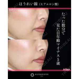 東京形成美容外科 船橋院 弓削田　浩主医師の症例