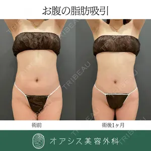オアシス美容外科の症例