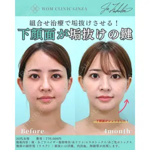 WOM CLINIC GINZA （ワム クリニック ギンザ） 深堀 純也医師の症例