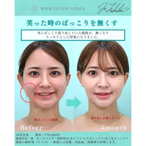 WOM CLINIC GINZA （ワム クリニック ギンザ） 深堀 純也医師の症例