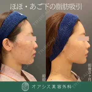 オアシス美容外科 遠藤 剛史医師の症例