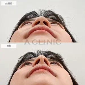 A CLINIC（エークリニック） 大阪院 木家 佑理子医師の症例