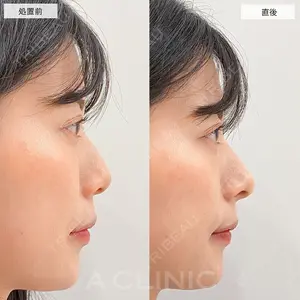 A CLINIC（エークリニック） 大阪院 木家 佑理子医師の症例