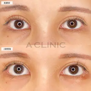 A CLINIC（エークリニック） 池袋院 三橋 克之医師の症例