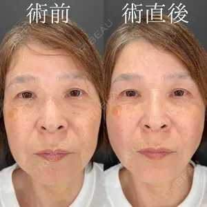 HAAB×DREAM BEAUTY CLINIC 大阪梅田院 鈴木 馨斗医師の症例