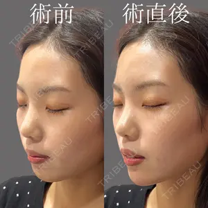 HAAB BEAUTY CLINIC 名古屋院の症例