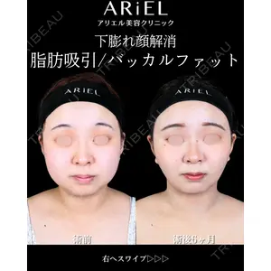 アリエル美容クリニック 大宮院 鈴木　桂介医師の症例