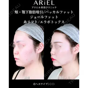 アリエル美容クリニック 大宮院 鈴木　桂介医師の症例