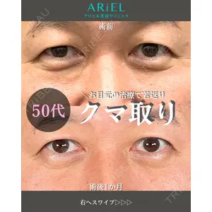 アリエル美容クリニック 大宮院 鈴木　桂介医師の症例