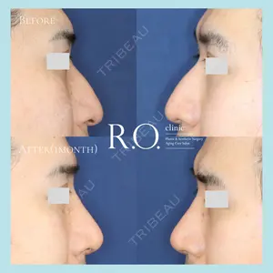 R.O.clinic 呂 秀彦医師の症例