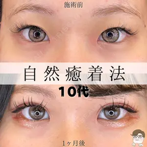 ルラ美容クリニック 札幌院 佐藤 雄紀医師の症例