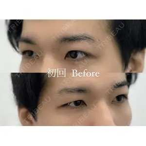 APスキンクリニック銀座 越原あすか｜アートメイク医師の症例