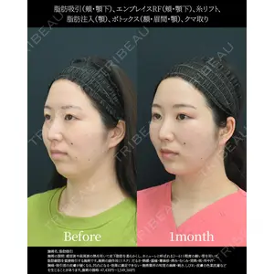 湘南美容クリニック 名古屋院 山本 高士医師の症例