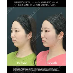 湘南美容クリニック 名古屋院 山本 高士医師の症例