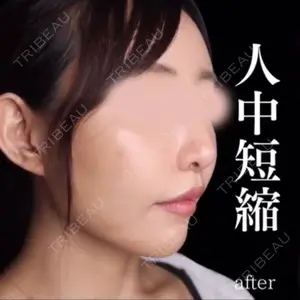 吉祥寺アイビークリニック 升本　浩紀医師の症例