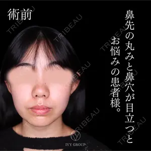吉祥寺アイビークリニック 升本　浩紀医師の症例