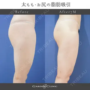 ガーデンクリニック 池袋院の症例