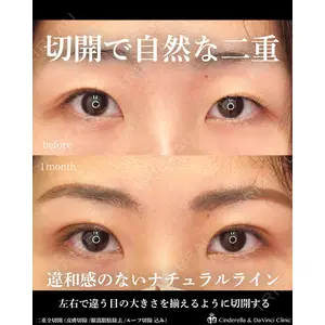 シンデレラ＆ダヴィンチクリニック 宮田 洋佑医師の症例