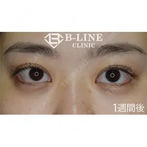 B-LINE CLINIC 池袋院 小池 康弘医師の症例