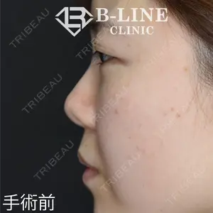 B-LINE CLINIC 池袋院 小池 康弘医師の症例