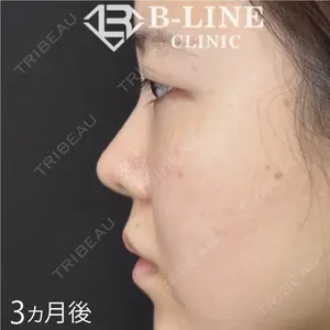 B-LINE CLINIC 池袋院 小池 康弘医師の症例