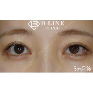 B-LINE CLINIC 池袋院 小池 康弘医師の症例