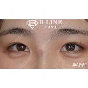 B-LINE CLINIC 池袋院 小池 康弘医師の症例