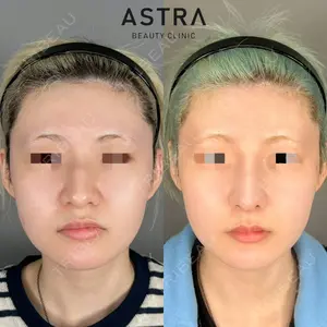 ASTRA BEAUTY CLINIC 塩満 惠子医師の症例