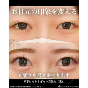 シンデレラ＆ダヴィンチクリニック 宮田 洋佑医師の症例