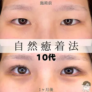 ルラ美容クリニック 札幌院 佐藤 雄紀医師の症例