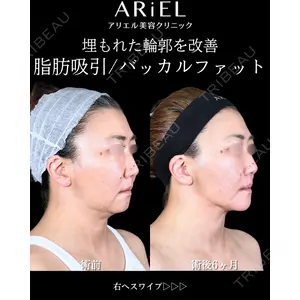 アリエル美容クリニック 大宮院 鈴木　桂介医師の症例