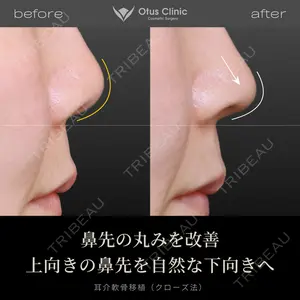 Otus Clinic 【オータスクリニック】 中 徳太郎医師の症例