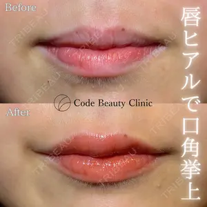 Code Beauty Clinic 名古屋院 橋本 祥平医師の症例