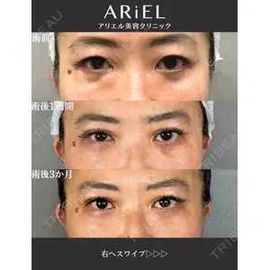 アリエル美容クリニック 大宮院 鈴木　桂介医師の症例