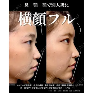グローバルビューティークリニック 大阪院の症例