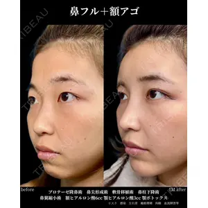 グローバルビューティークリニック 大阪院の症例