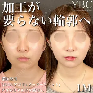 YBC横浜美容外科 大宮院 磯村 亮輔医師の症例