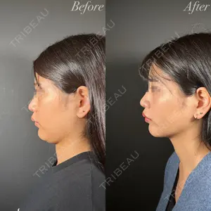 R Beauty CLINIC 名古屋院 木村 尚大医師の症例