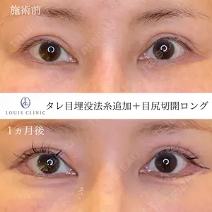 LOUIS CLINIC 二子玉川院【ルイクリニック】 小松 塁医師の症例
